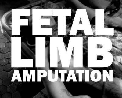 logo Fetal Limb Amputation